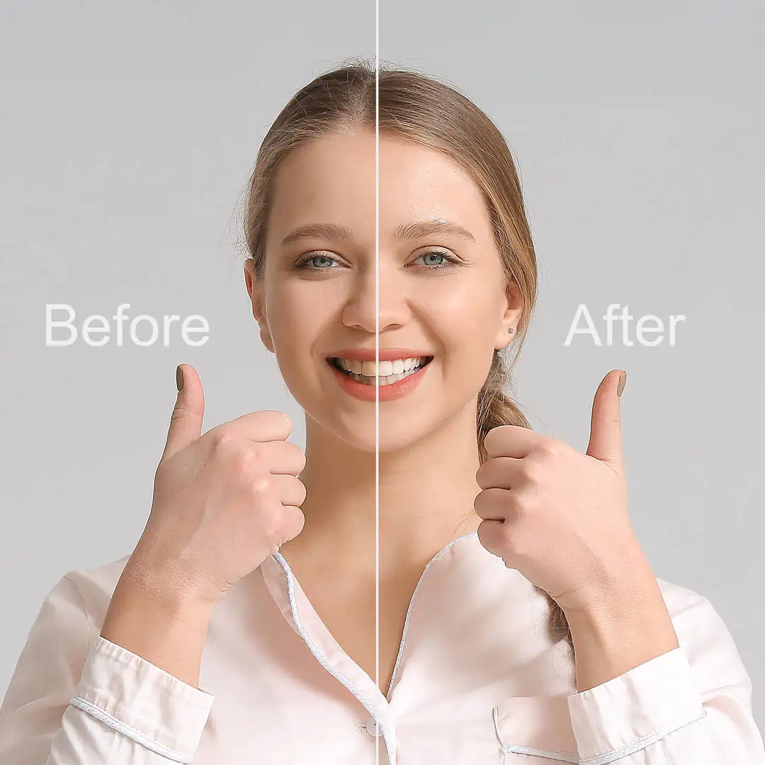 Smile makeover in Golden, CO